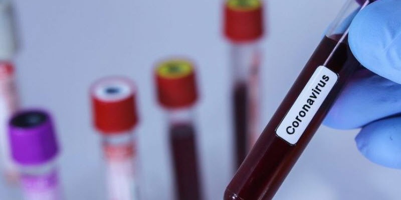 В Новороссийске зарегистрировано 5 новых заболевших коронавирусом, на Кубани - 132