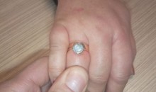 Реакция на аллергию: в Новороссийске у женщины распух палец, кольцо пришлось экстренно снимать