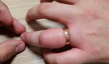 Пришлось резать: Новороссийские спасатели помогли парню снять кольцо с распухшего пальца